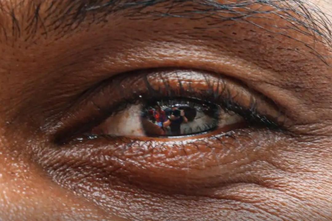 Pessoas desconhecem riscos ao escanear a íris, alertam especialistas
